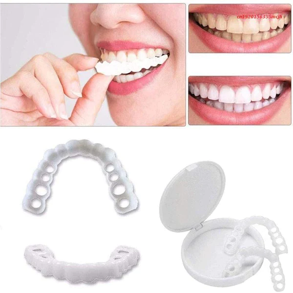 Lente de Resina Dental White® - Kit Superior + Inferior (TOTALMENTE AJUSTÁVEL A TODAS ARCADAS DENTÁRIAS)